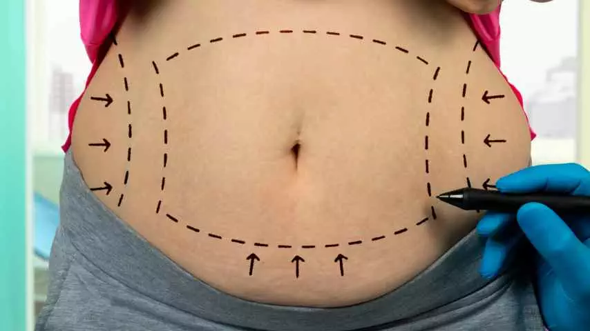 An Inside Look at How Body Contouring Works - Figura Medspa